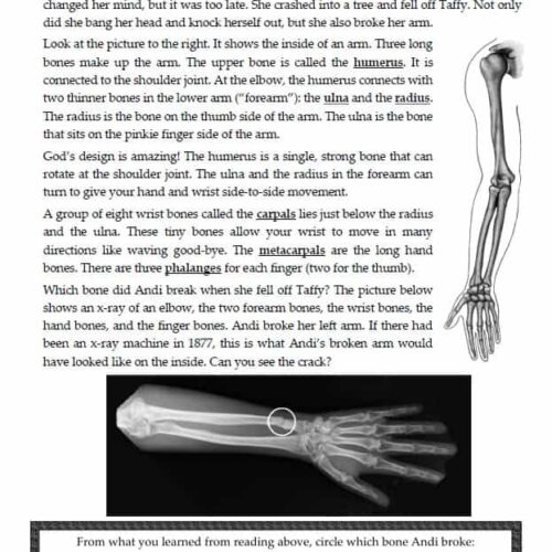 Broken arm x-ray image showing the humerus, ulna, and radius bones with a visible fracture, part of an educational resource about understanding arm injuries, bones, and anatomy for homeschooling science lessons.