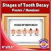 Stages of Tooth Decay Poster / Handout Educational poster illustrating the stages of tooth decay, from healthy tooth to pulp infection, ideal for homeschooling dental health lessons.
