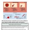 original-12090964-1.jpg Diagram illustrating different types of wound patterns: lacerations, blunt force trauma, and gunshot wounds, with details on severity and injury characteristics.