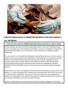original-12104297-1.jpg Forensic dentist examining dental remains with tools, highlighting the importance of dental records in forensic investigations.