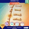 Educational infographic on types of bone fractures for grades 9-12, showing different fracture types with illustrations and icons for teaching.