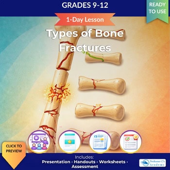 Educational infographic on types of bone fractures for grades 9-12, showing different fracture types with illustrations and icons for teaching.