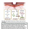 original-12626662-1.jpg Diagram illustrating tissue repair and scar formation process, including fibroblast activity, cell migration, and ECM synthesis.