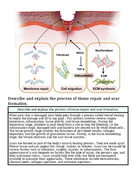 original-12626662-1.jpg Diagram illustrating tissue repair and scar formation process, including fibroblast activity, cell migration, and ECM synthesis.
