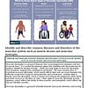 original-12627076-1.jpg Illustration of three children with muscular dystrophy types: Duchenne, Becker, and Limb-Girdle, showing physical differences and mobility aids.