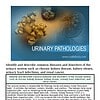 original-12632591-1.jpg Urinary pathologies including kidney stones, infections, and tumors, with microscopic view of bacteria and urinary system diagram.
