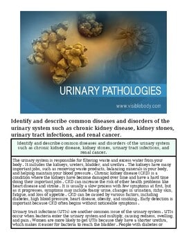 original-12632591-1.jpg Urinary pathologies including kidney stones, infections, and tumors, with microscopic view of bacteria and urinary system diagram.