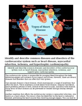 original-12639176-1.jpg Illustration of various types of heart disease including cardiomyopathy, arrhythmia, and coronary artery disease with labeled diagrams.