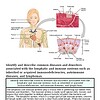 original-12649507-1.jpg Diagram illustrating common diseases and disorders linked to the immune system, including autoimmune and infectious diseases, with detailed labels.