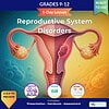 original-12651922-1.jpg Illustration of the female reproductive system highlighting reproductive system disorders, suitable for educational purposes.