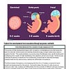 original-12502986-1.jpg Diagram illustrating fetal development stages from 0 to 9 weeks, including germinal, embryonic, and fetal stages.