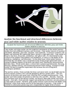 Diagram illustrating the structural differences between gray and white matter in the brain, highlighting their locations and functions.