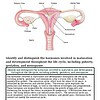 Detailed diagram of the female reproductive system showing ovaries, fallopian tubes, uterus, cervix, and vagina with labels.